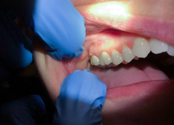 Best Emergency Cosmetic Dentistry in Brisbane, CA