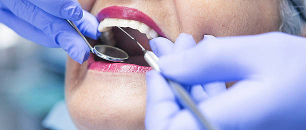 Best Emergency Cosmetic Dentistry in Brisbane, CA